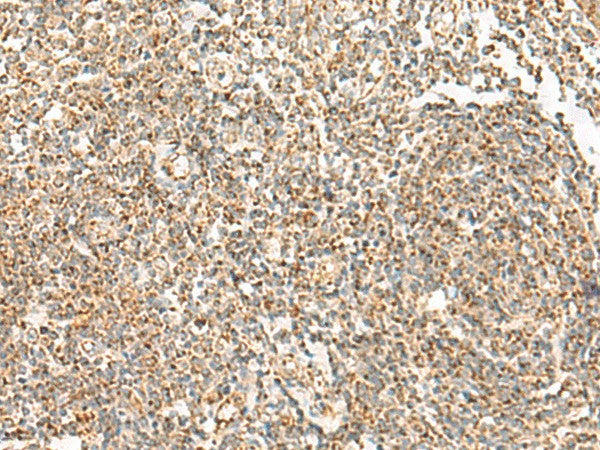 ORC4 Polyclonal Antibody – Figure 1 of 3