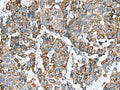 PRELID3B Polyclonal Antibody – Figure 1 of 3
