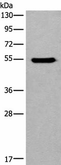 CYP11B2 Polyclonal Antibody – Figure 1 of 3