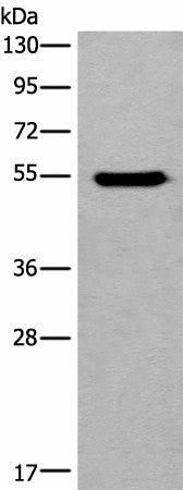 CYP11B2 Polyclonal Antibody – Figure 1 of 3