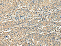 CCDC112 Polyclonal Antibody – Figure 1 of 3