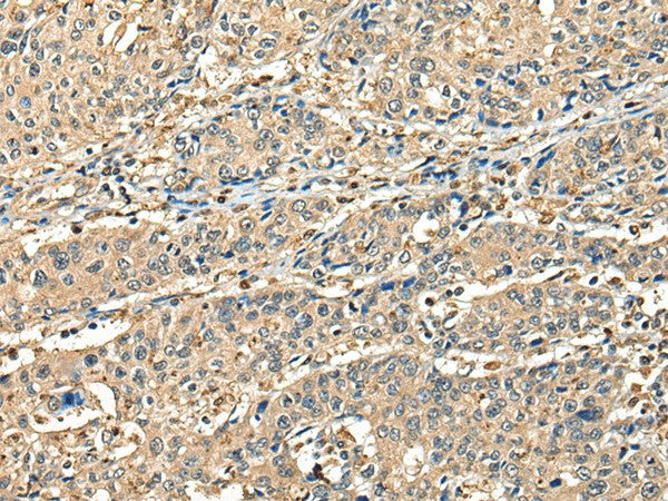 CCDC112 Polyclonal Antibody – Figure 1 of 3