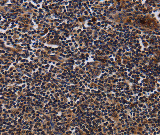 NTMT1 Polyclonal Antibody – Figure 1 of 2