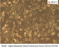 Highly Metastatic Distant Pulmonary Tumor Cell Line (T4-PA) | Applied Biological Materials (abm)
