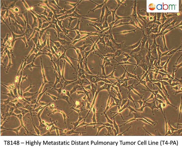 Highly Metastatic Distant Pulmonary Tumor Cell Line (T4-PA) | Applied Biological Materials (abm)
