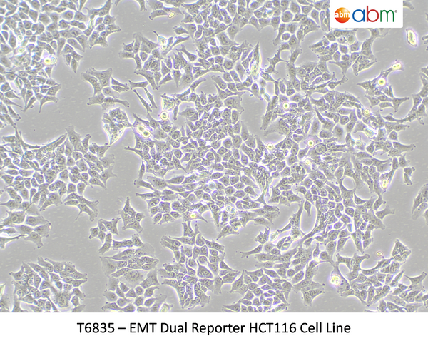 EMT Dual Reporter HCT116 Cell Line | Applied Biological Materials (abm)