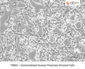 Immortalized Human Prostate Stromal Cells – Figure 1 of 1