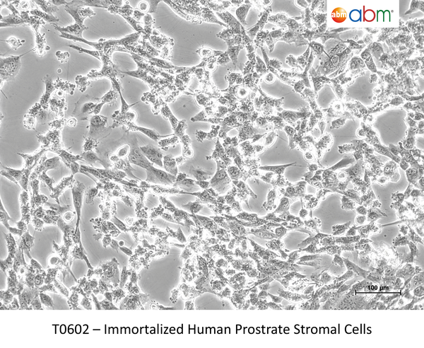 Immortalized Human Prostate Stromal Cells – Figure 1 of 1