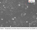 Temperature-sensitive Ovarian Carcinoma Cell Line (OvBH-1) | Applied Biological Materials (abm)