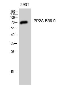 Western Blot analysis of 293T cells using PP2A-B56-δ Polyclonal Antibody diluted at 1:1000 STJ95194