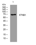 Western blot analysis of lysates from 293T cells, primary antibody was diluted at 1:1000, 4° overnight STJ194916
