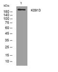 Western blot analysis of lysates from 293T cells, primary antibody was diluted at 1:1000, 4° overnight STJ195226
