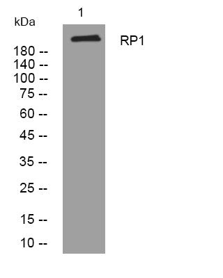 Western blot analysis of lysates from 293T cells, primary antibody was diluted at 1:1000, 4°C overnight STJ196010