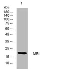 Western blot analysis of lysates from 293T cells, primary antibody was diluted at 1:1000, 4°C overnight STJ196017