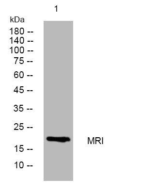 Western blot analysis of lysates from 293T cells, primary antibody was diluted at 1:1000, 4°C overnight STJ196017
