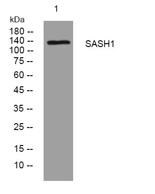 Western blot analysis of lysates from A431 cells, primary antibody was diluted at 1:1000, 4°C overnight STJ195816