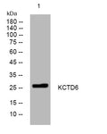 Western blot analysis of lysates from A549 cells, primary antibody was diluted at 1:1000, 4°C overnight STJ194800
