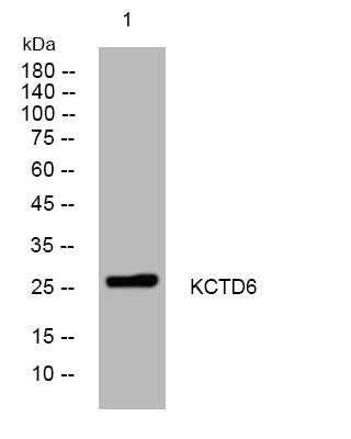 Western blot analysis of lysates from A549 cells, primary antibody was diluted at 1:1000, 4°C overnight STJ194800