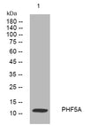 Western blot analysis of lysates from AD293 cells, primary antibody was diluted at 1:1000, 4°C overnight STJ195409