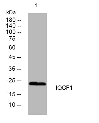 Western blot analysis of lysates from CACO2 cells, primary antibody was diluted at 1:1000, 4°C overnight STJ194805