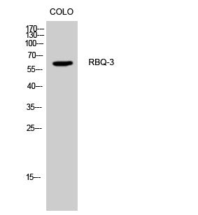 Western blot analysis of CoLo cells using RBQ-3 polyclonal antibody, cells nucleus extracted by Minute™ Cytoplasmic and STJ95394