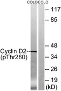 Western blot analysis of lysates from COLO205 cells treated with EGF 200 ng/ml for 30', using Cyclin D2 STJ90627