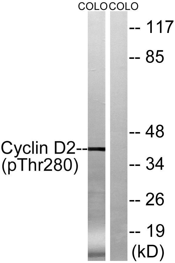 Western blot analysis of lysates from COLO205 cells treated with EGF 200 ng/ml for 30', using Cyclin D2 STJ90627