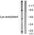 Western blot analysis of lysates from COS7 cells treated with TSA 400 µM 24 h, using Lys-Acetylated Proteins Antibody. STJ90135