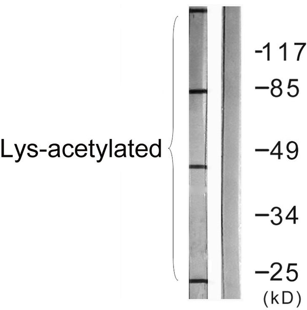 Western blot analysis of lysates from COS7 cells treated with TSA 400 µM 24 h, using Lys-Acetylated Proteins Antibody. STJ90135