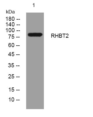 Western blot analysis of lysates from DU145 cells, primary antibody was diluted at 1:1000, 4°C overnight STJ194941
