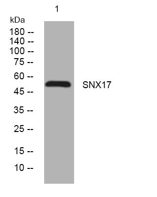 Western blot analysis of lysates from DU145 cells, primary antibody was diluted at 1:1000, 4°C overnight STJ195393