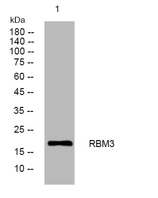 Western blot analysis of lysates from DU145 cells, primary antibody was diluted at 1:1000, 4°C overnight STJ196144