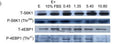 Western Blot (WB): Gao, Hai-na, et al. "Leucine and histidine independently regulate milk protein synthesis in bovine STJ90161