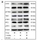 Hafnium oxide nanoparticles coated with ATR inhibitor to enhance radiotherapy and potentiate antitumor immune response STJ194750