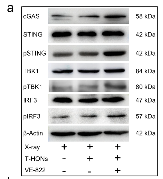 Hafnium oxide nanoparticles coated with ATR inhibitor to enhance radiotherapy and potentiate antitumor immune response STJ194750