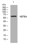 Western blot analysis of lysates from HCT116 cells, primary antibody was diluted at 1:1000, 4°C overnight STJ194907