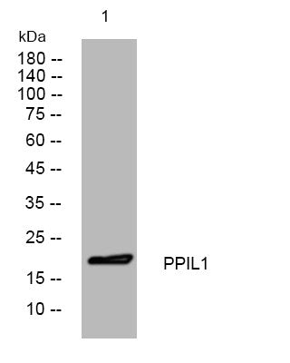 Western blot analysis of lysates from HEK293 cells, primary antibody was diluted at 1:1000, 4°C overnight STJ195441