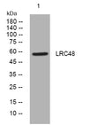 Western blot analysis of lysates from HeLa cells, primary antibody was diluted at 1:1000, 4°C overnight STJ195480
