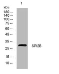 Western blot analysis of lysates from HeLa cells, primary antibody was diluted at 1:1000, 4°C overnight STJ195612