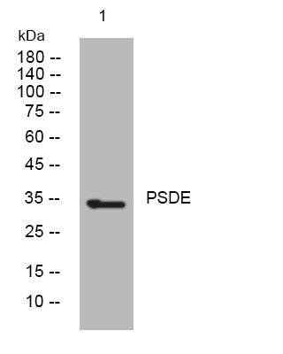 Western blot analysis of lysates from HeLa cells, primary antibody was diluted at 1:1000, 4° overnight STJ195728
