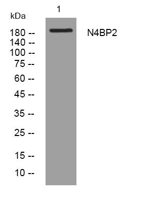 Western blot analysis of lysates from HeLa cells, primary antibody was diluted at 1:1000, 4° overnight STJ195853