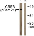 Western blot analysis of lysates from HeLa cells treated with Etoposide 25 μM 24 h, using CREB (Phospho-Ser121) STJ90463
