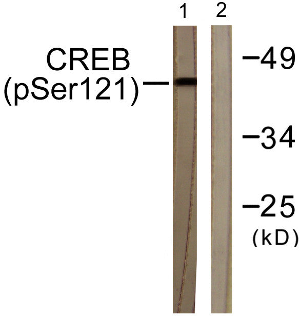 Western blot analysis of lysates from HeLa cells treated with Etoposide 25 μM 24 h, using CREB (Phospho-Ser121) STJ90463