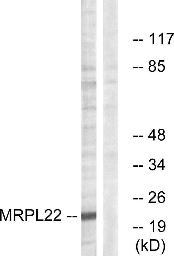 Western blot analysis of lysates from HepG2 cells, using MRPL22 Antibody. The lane on the right was blocked with the STJ94219