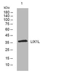 Western blot analysis of lysates from HepG2 cells, primary antibody was diluted at 1:1000, 4° overnight STJ194868