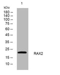 Western blot analysis of lysates from HepG2 cells, primary antibody was diluted at 1:1000, 4° overnight STJ195003