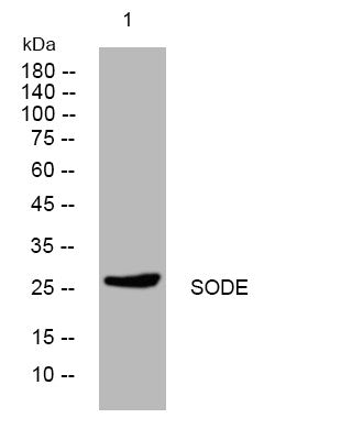 Western blot analysis of lysates from HepG2 cells, primary antibody was diluted at 1:1000, 4° overnight STJ195286