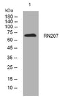 Western blot analysis of lysates from HepG2 cells, primary antibody was diluted at 1:1000, 4° overnight STJ195636