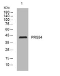 Western blot analysis of lysates from HepG2 cells, primary antibody was diluted at 1:1000, 4°C overnight STJ195667