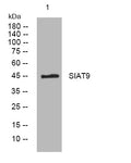 Western blot analysis of lysates from HepG2 cells, primary antibody was diluted at 1:1000, 4° overnight STJ196032